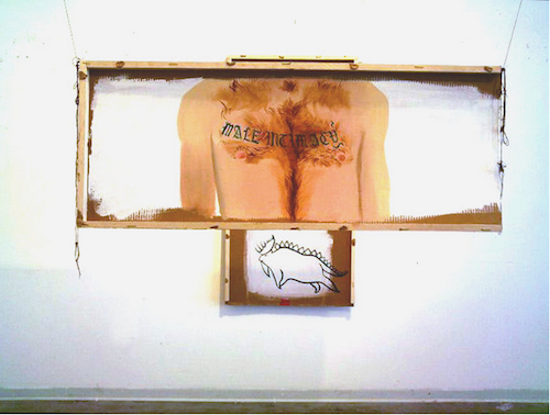 ART1