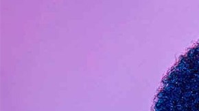 Photo by Monik Molinet