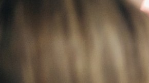 Skilled female plastic surgeon and dermatologist, doing the brow lift procedure on the young female client, while using the botox fillers, in her modern ordination