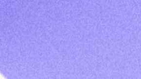 Caloncho_Daniel, Me Estás Matando_'Ven A Mi Show