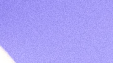 Caloncho_Daniel, Me Estás Matando_'Ven A Mi Show